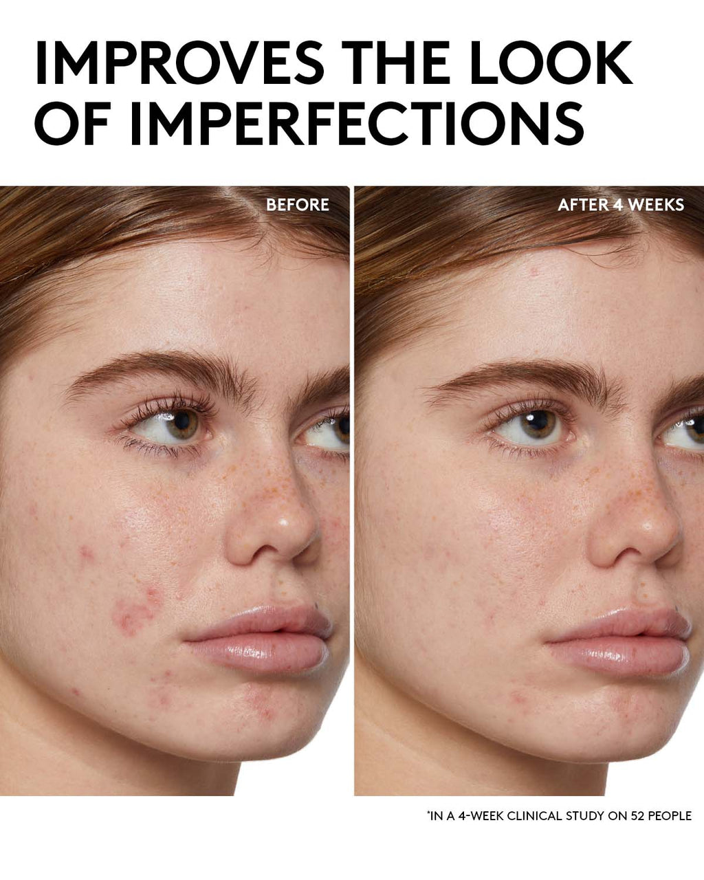 Cherry Dub BHA Toner with Salicylic Acid + Aloe Juice