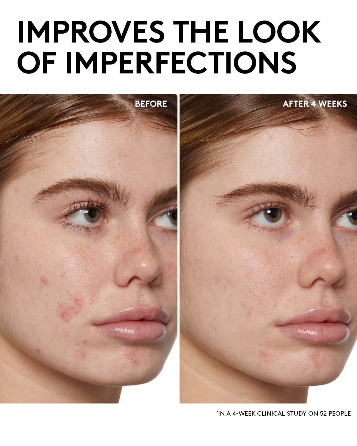 Fenty Skin Start’rs Full-Size Bundle: Oily Skin Edition